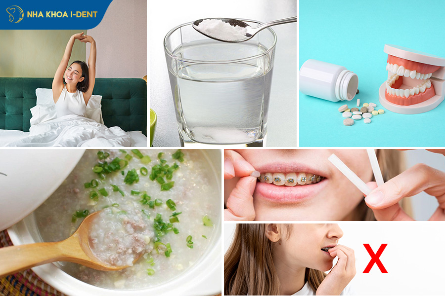 niềng răng giai đoạn nào đau nhất