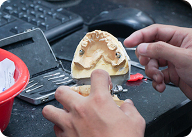 Owned Cad/Cam Ceramic Lab For Accurate And Fast Production