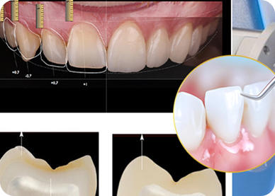 Owned Cad/Cam Ceramic Lab For Accurate And Fast Production