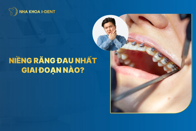Giai Đoạn Đau Nhất Của Niềng Răng Là Khi Nào