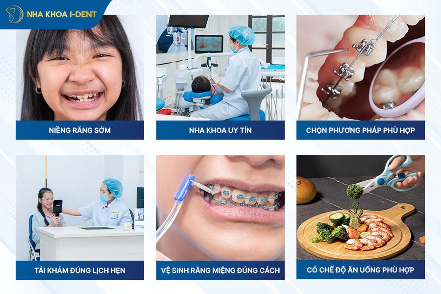 Cách rút ngắn tối đa thời gian niềng răng nhanh nhất tuân 