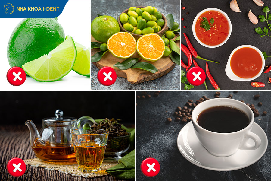 sau khi ytẩy trắng răng cần lưu ý gì