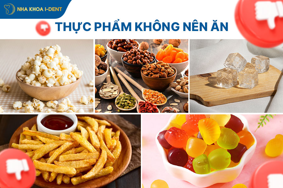 thực phẩm không nên ăn khi vừa mới niềng răng