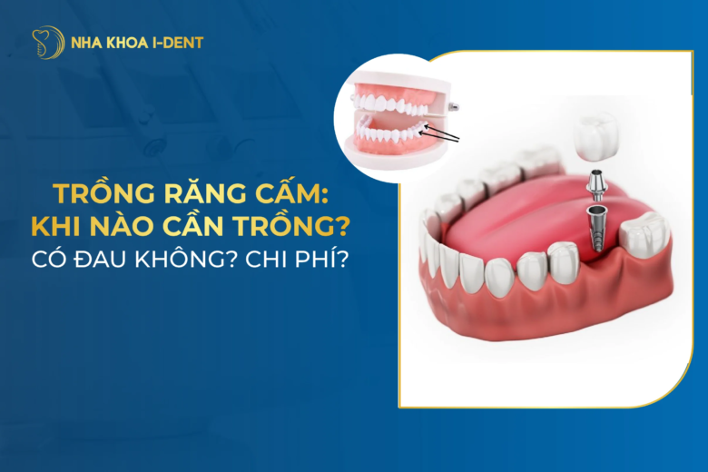 Trồng răng cấm