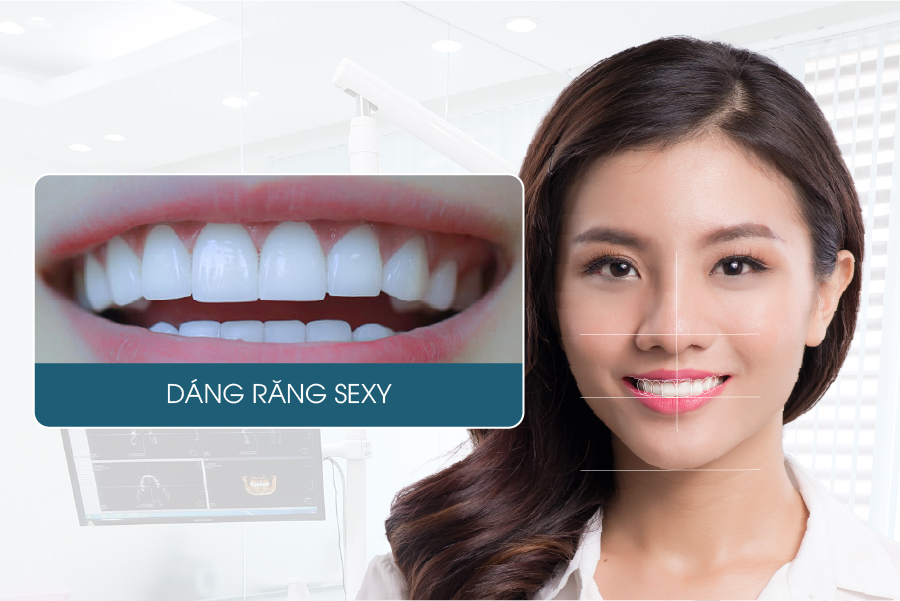 form răng sứ đẹp