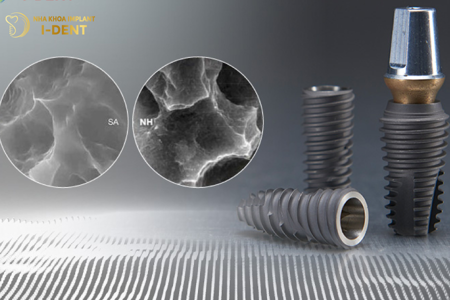 Hiossen Implant có tuổi thọ bền lâu nếu được chăm sóc tốt