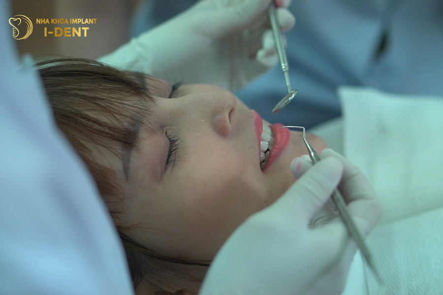 các dáng răng đẹp