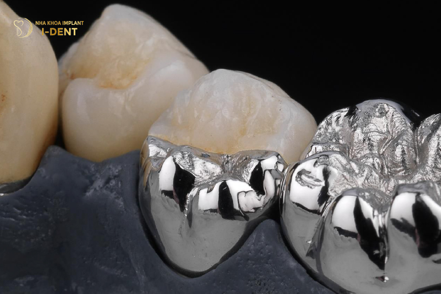 Hình ảnh răng sứ Chrome Cobalt