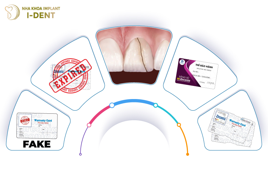 Những trường hợp thẻ bảo hành răng sứ không có hiệu lực