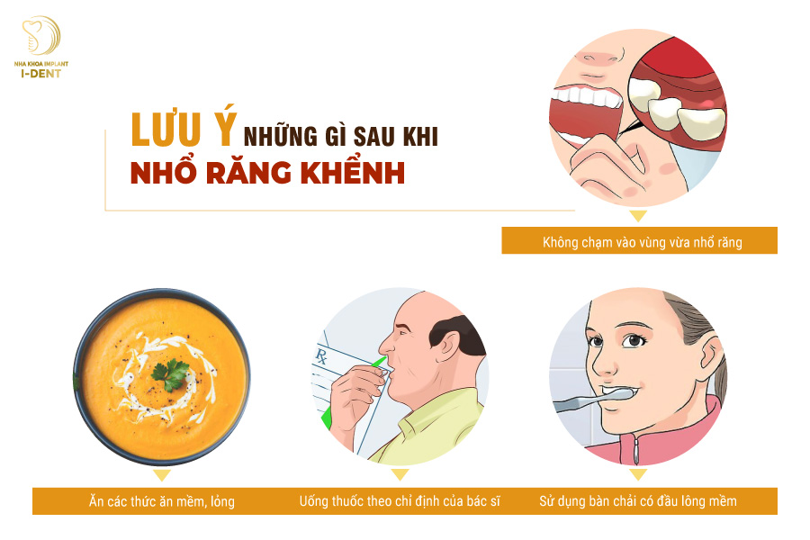 Cần lưu ý những gì sau khi nhổ răng khểnh