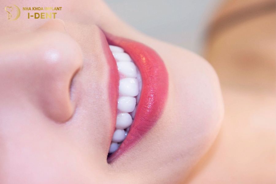 Răng sứ Venus có tốt không