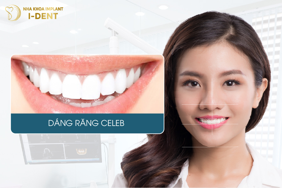 Dáng răng sứ celeb