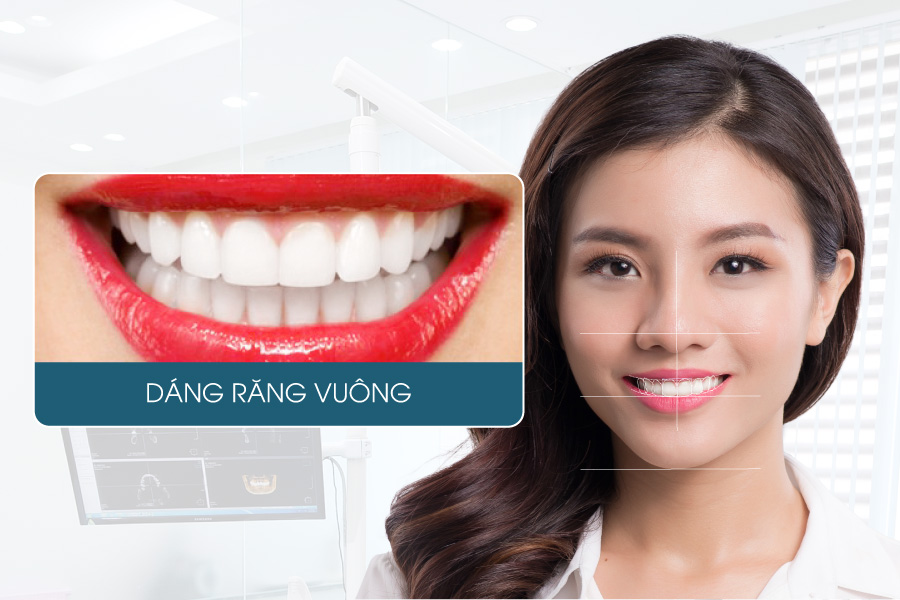 răng sứ đẹp nhất