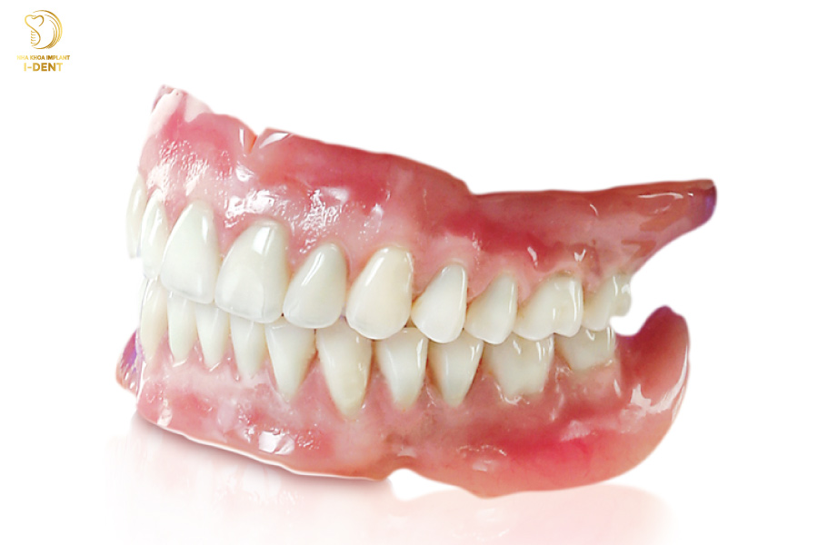 giá trồng răng cấm