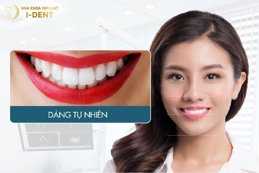 răng sứ tự nhiên