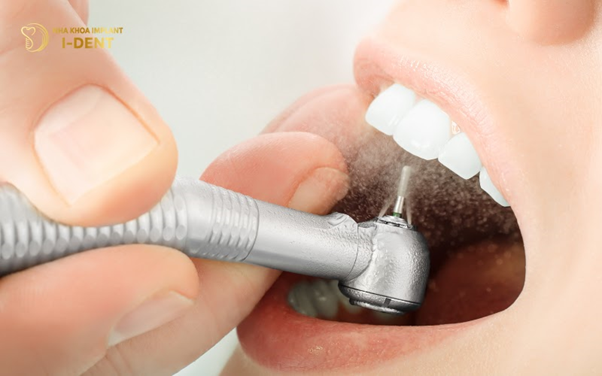 hình ảnh làm cầu răng sứ