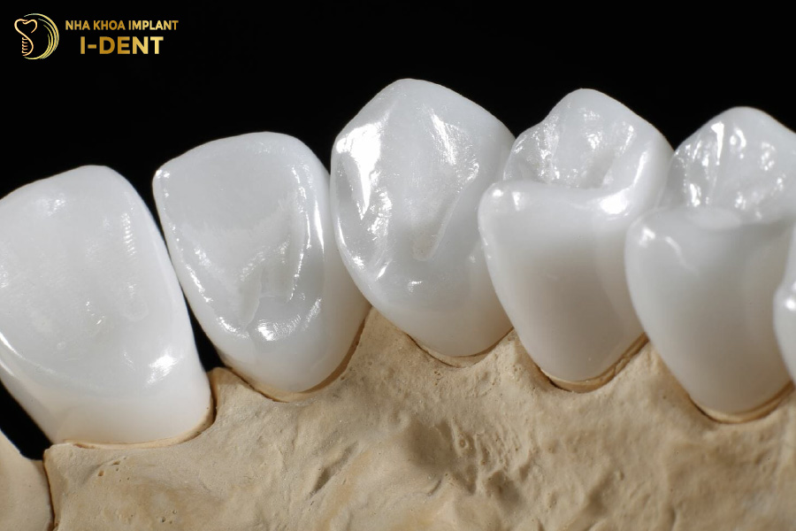 chân răng sứ bị hôi