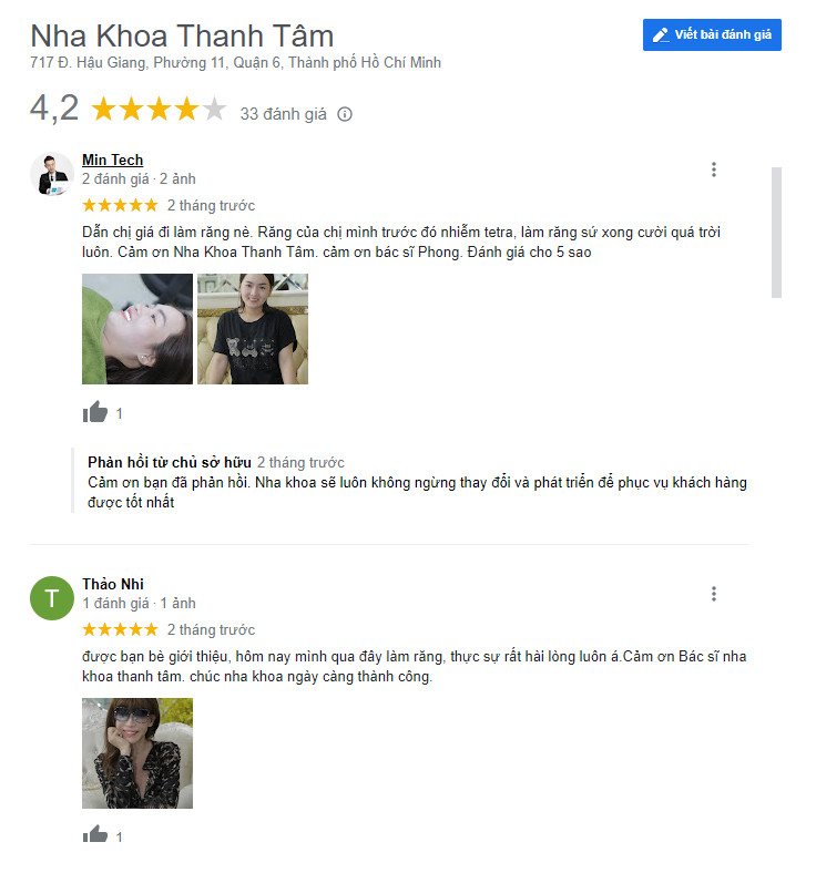 làm răng sứ ở đâu tốt nhất