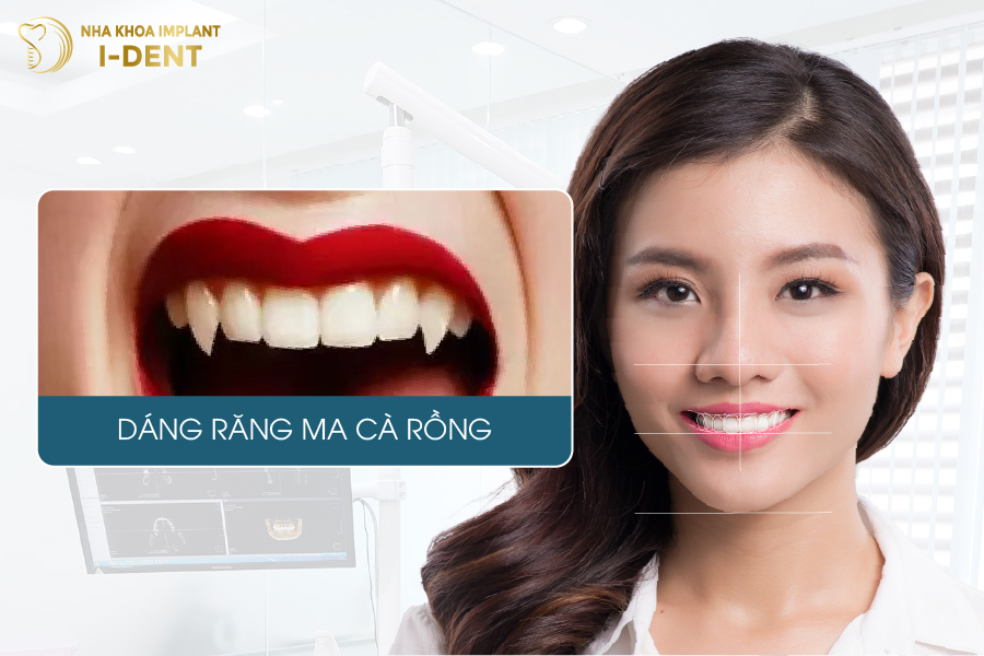 các dáng răng sứ