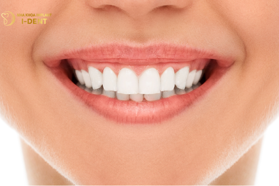 Phương pháp bọc răng sứ thẩm mỹ