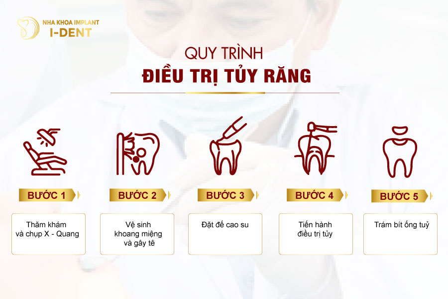 Quy trình lấy tủy cho trẻ tại Nha khoa I - DENT