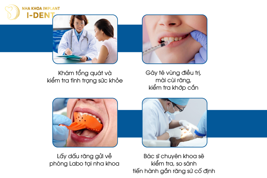 bọc răng sứ bị hỏng