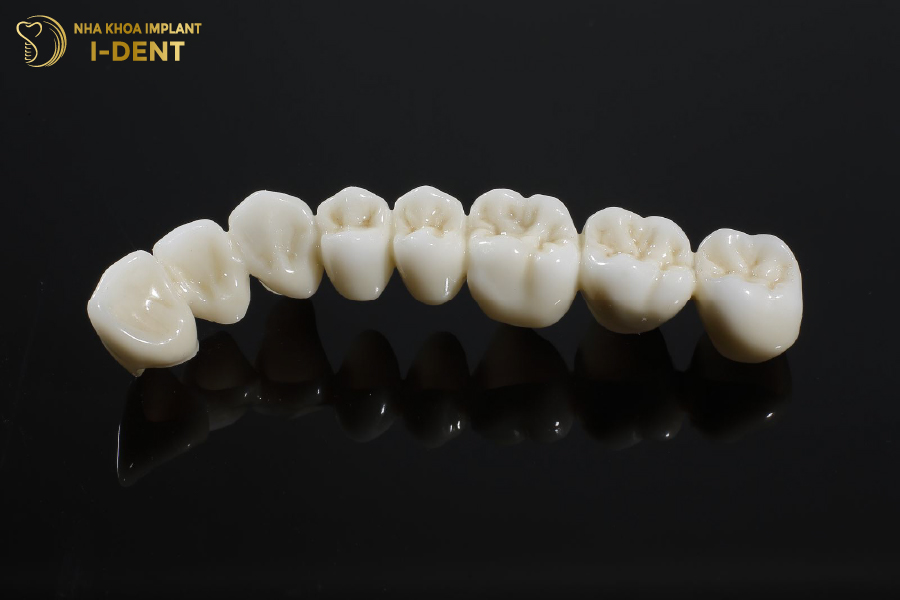 Răng sứ Venus là dòng sứ cao cấp