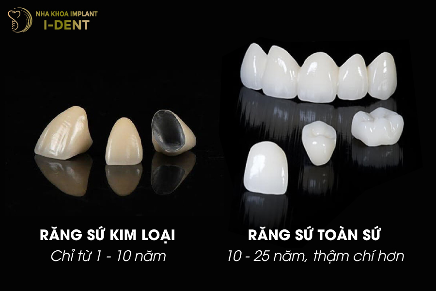 Thời gian sử dụng của răng sứ kim loại và răng sứ toàn sứ