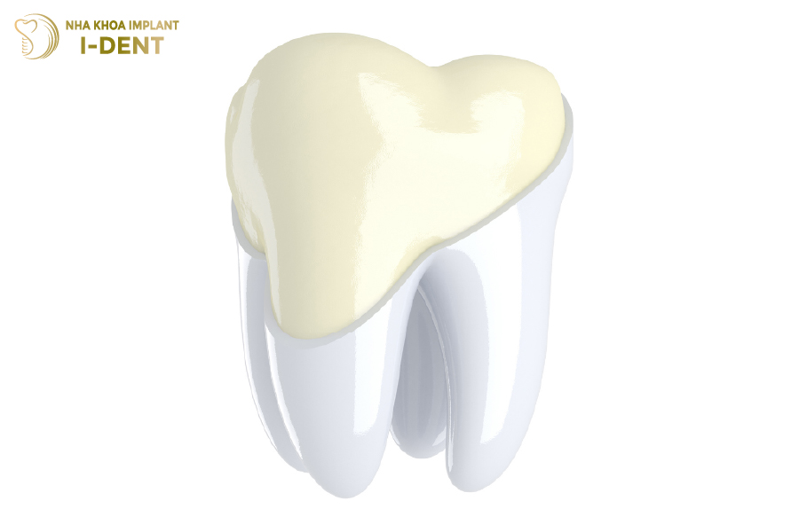 Tráng men răng sử dụng lớp men nhân tạo để củng cố răng chắc khỏe 