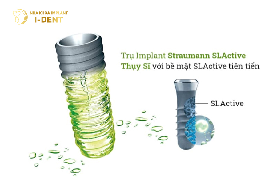 thời gian trồng răng implant