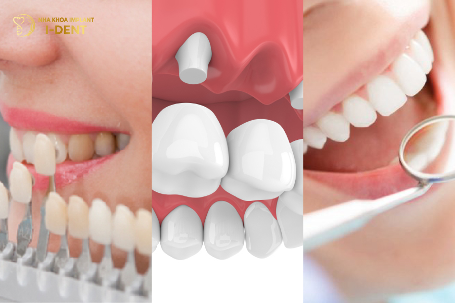 mài răng bọc sứ có ảnh hưởng gì không